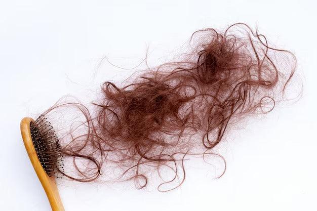 Conheça 5 principais tipos de alopecia