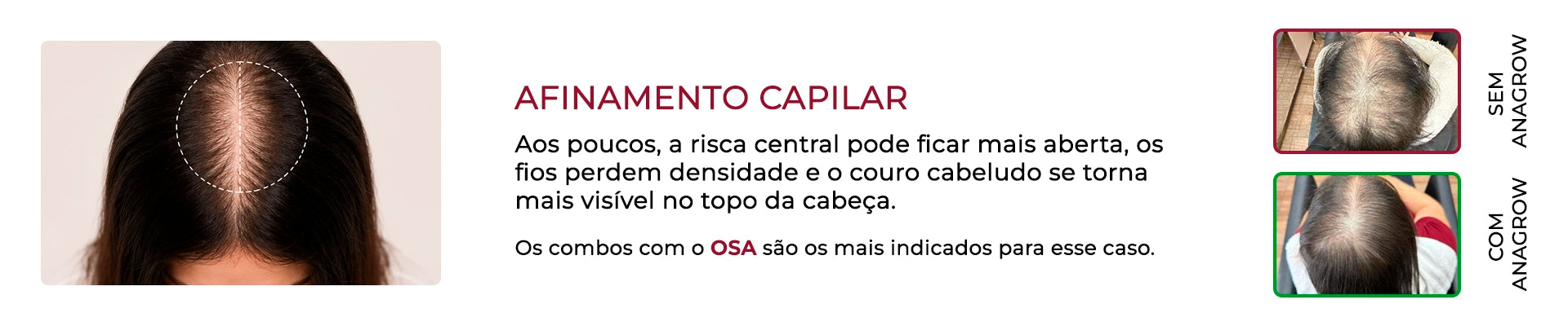 Promoção