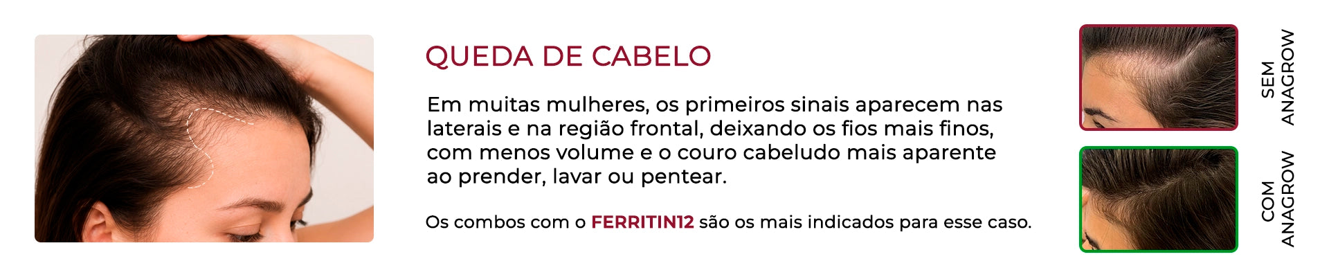 Promoção