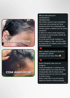Vitamina de Combate à Queda de Cabelo Ferritin12 60 Cápsulas + 5 E-books
