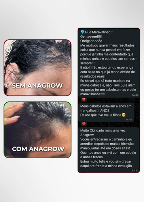Vitamina de Combate à Queda de Cabelo Ferritin12 60 Cápsulas + 5 E-books