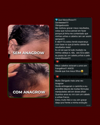 Vitamina de Combate à Queda de Cabelo Ferritin12 60 Cápsulas — foto 2