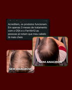 Kit Antiqueda e Fortalecimento Capilar | FERRITIN12 + OSA + 5 E-BOOKS
