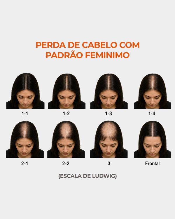 Escala de Ludwig - Afinamento