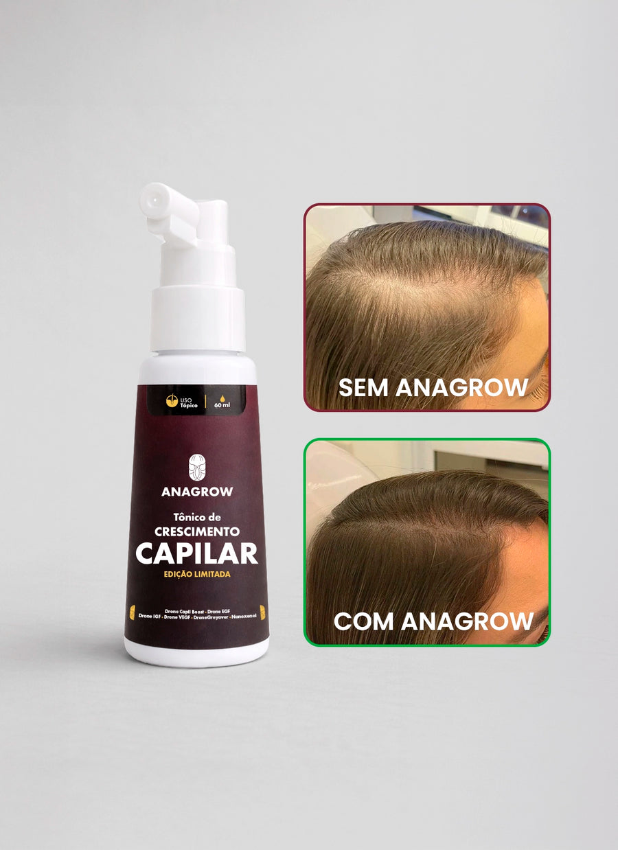 Tônico de Crescimento Capilar 60ml + E-books